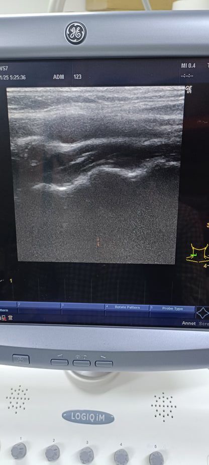 Ge 11L linear probe sn. 150711WP0 CHECKED OK DXB