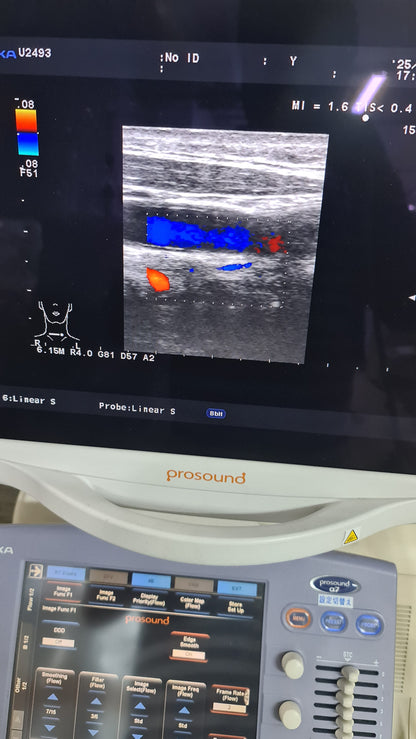 Aloka UST-5412 liner prob SN. M02414 checked