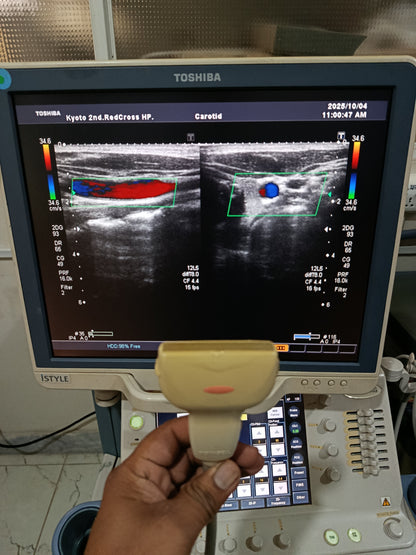 P..Toshiba PLT-805AT Linear Probe