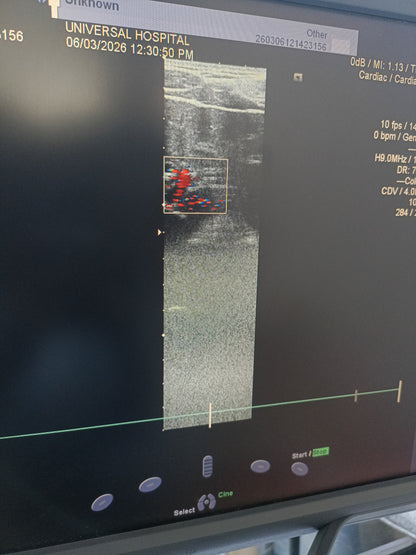 Siemens linear probe sn. (21)80452028 moy. 2018 checked dxb IS (MW) - Japan Medical Company LTD