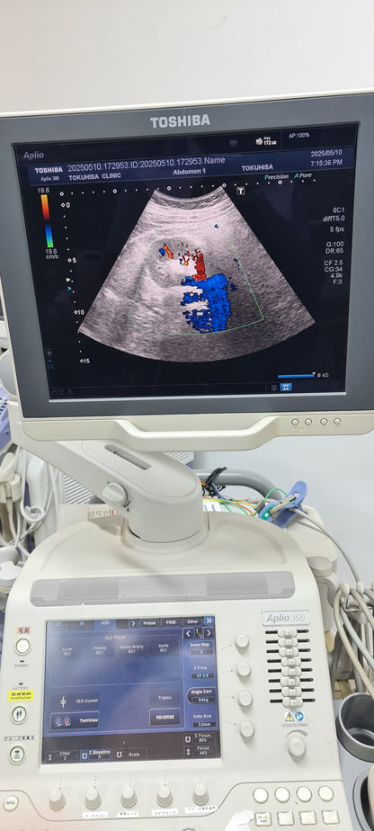 Toshiba PVT-375BT 6C1 Convex Prob Checked SN: FDA1235741 dxb