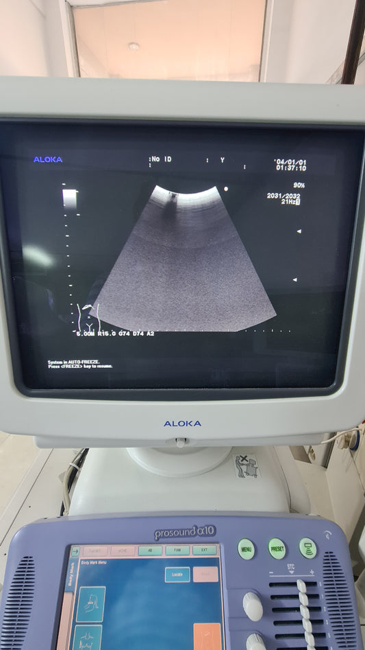 Aloka UST-9130 CONVEX checked SN. M05159C