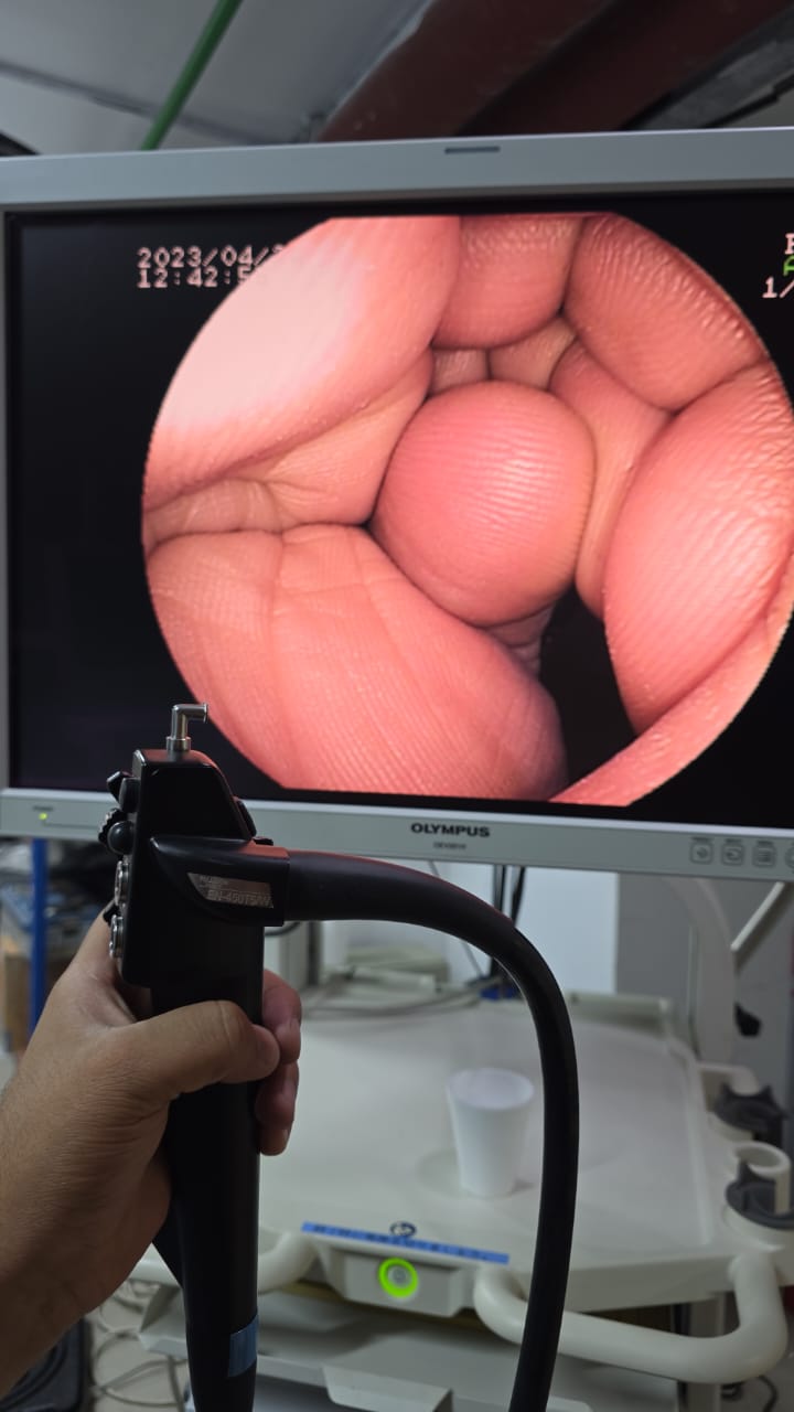 Fujinon EN-450T5/W S.NO: A0171C563 checked DXB