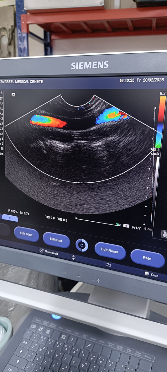 Siemens TVS PROBE SN. (21)64138010 CHECKED DXB IS - Japan Medical Company LTD