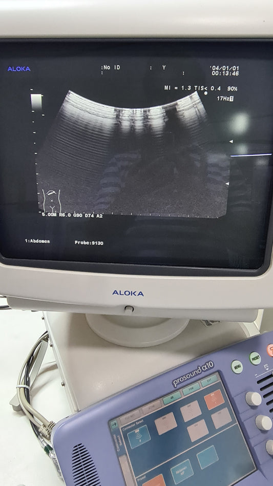 Aloka UST-9130 CONVEX SN. X00C0448 CHECKED