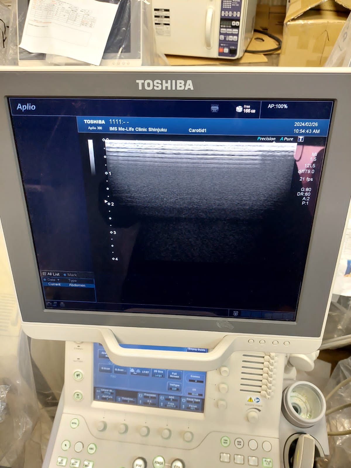 Toshiba Aplio 300 with convex linear probes. ( PVT-375BT, PLT-805AT) - Japan Medical Company LTD