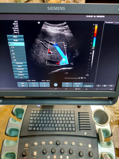 Siemens Acuson X700 with convex And Linear Probes - Japan Medical Company LTD