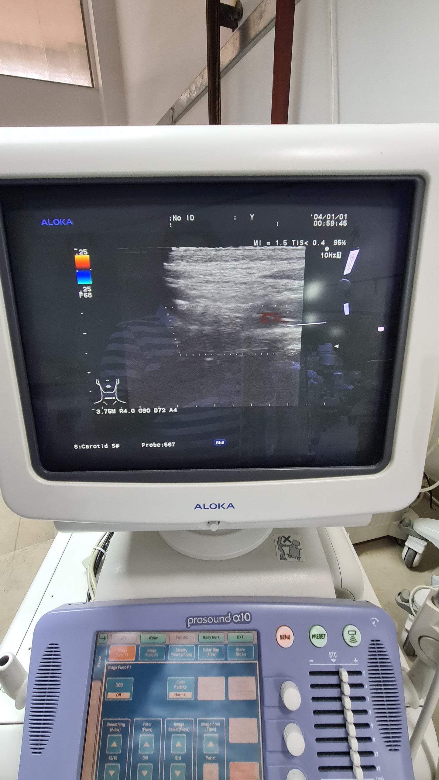 Z..Aloka UST 5413 linear Probe checked dxb
