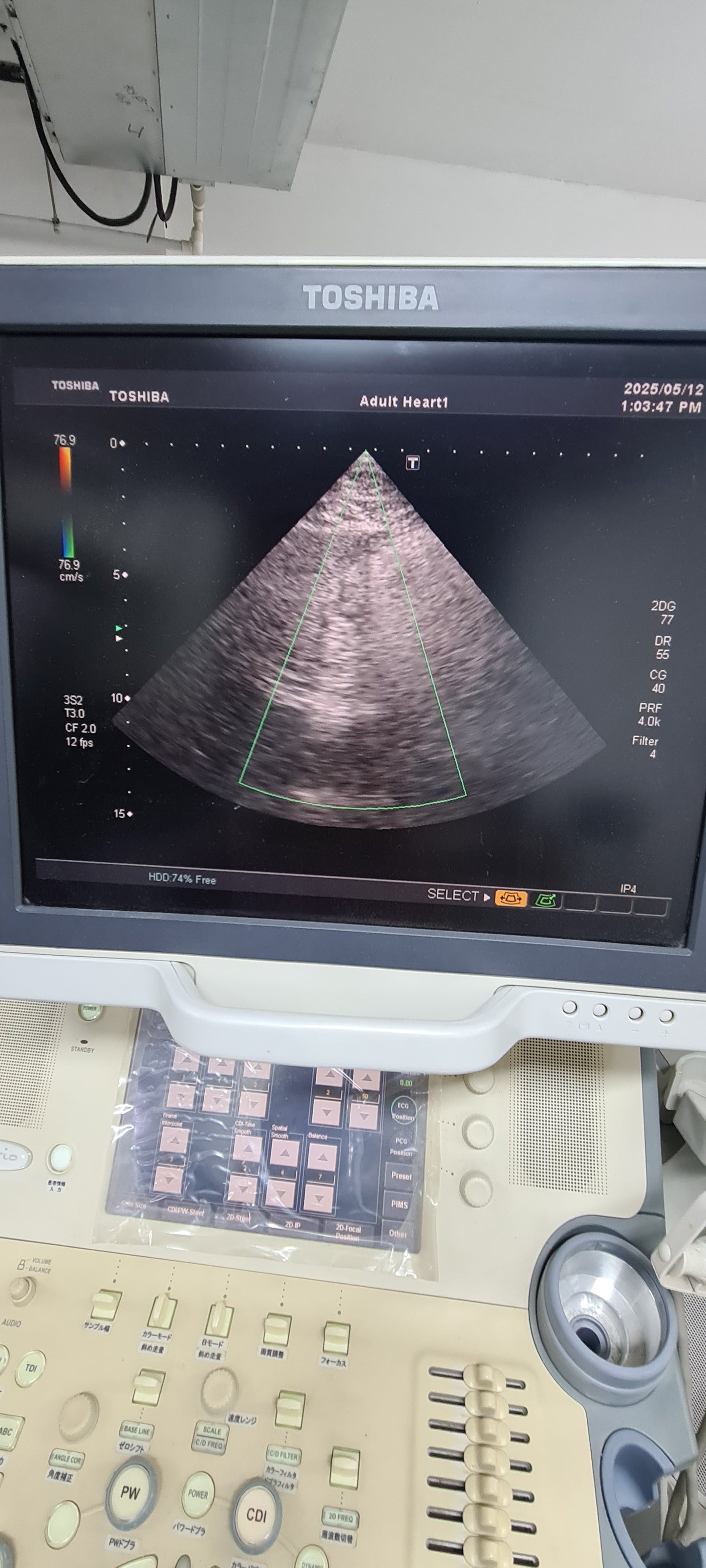 Toshiba PST-20CT Cardiac Prob SN: 99A0632411 checked DXB