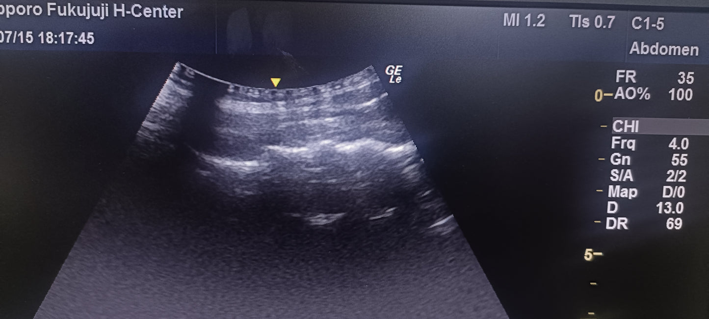 C1-5 RS  Av  (13) CHECKED NOT OK DXB