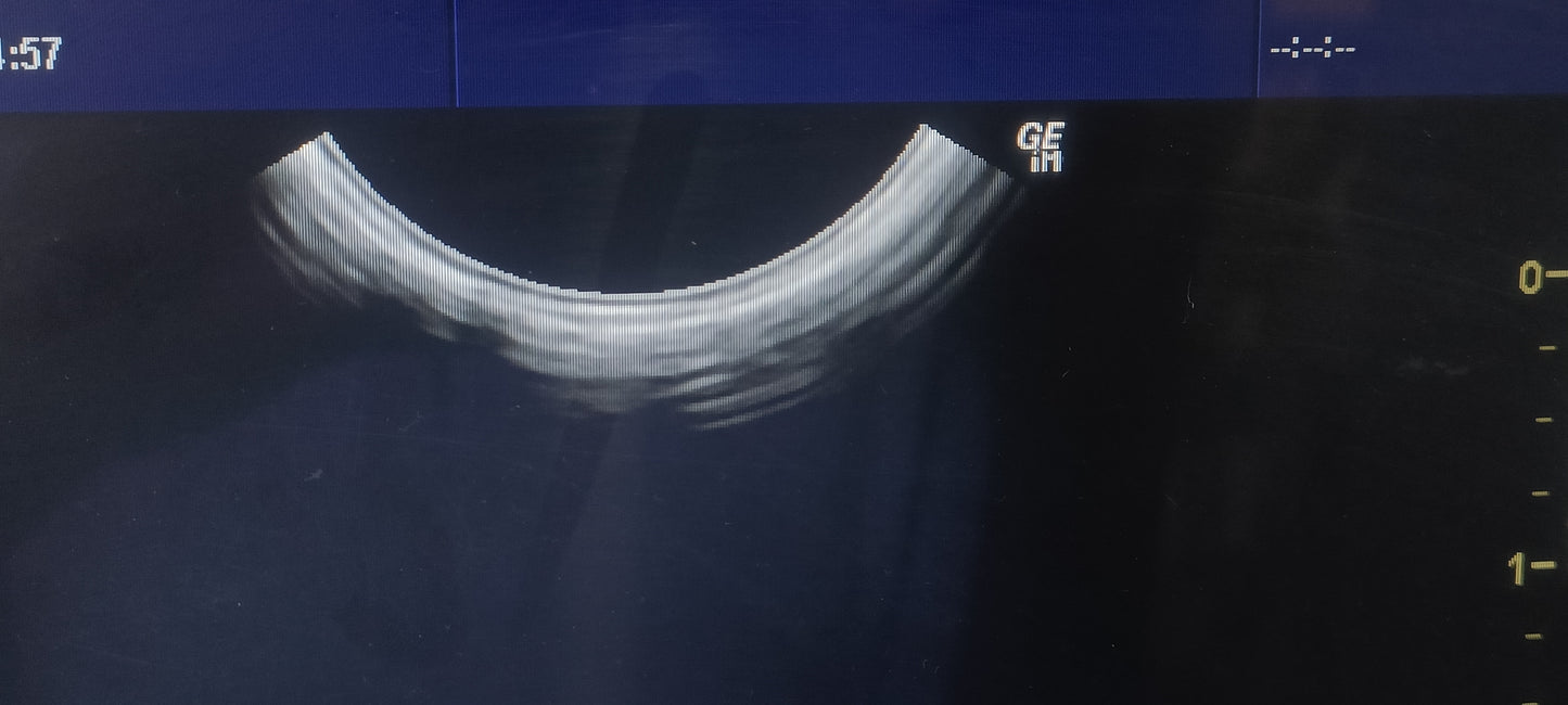 GE E8C TVS PROBE SN. 905416WX4 maf. 2020 checked dxb IS - Japan Medical Company LTD