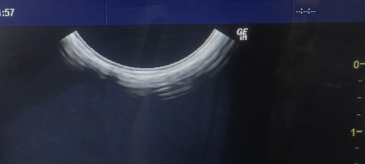 GE E8C TVS PROBE SN. 905416WX4 maf. 2020 checked dxb IS - Japan Medical Company LTD