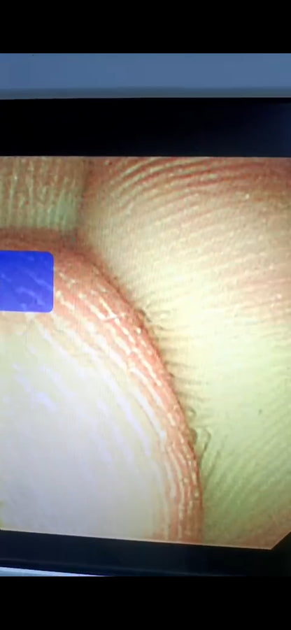OLYMPUS GIF-XP260N GASTROSCOPE DXB checked and ok