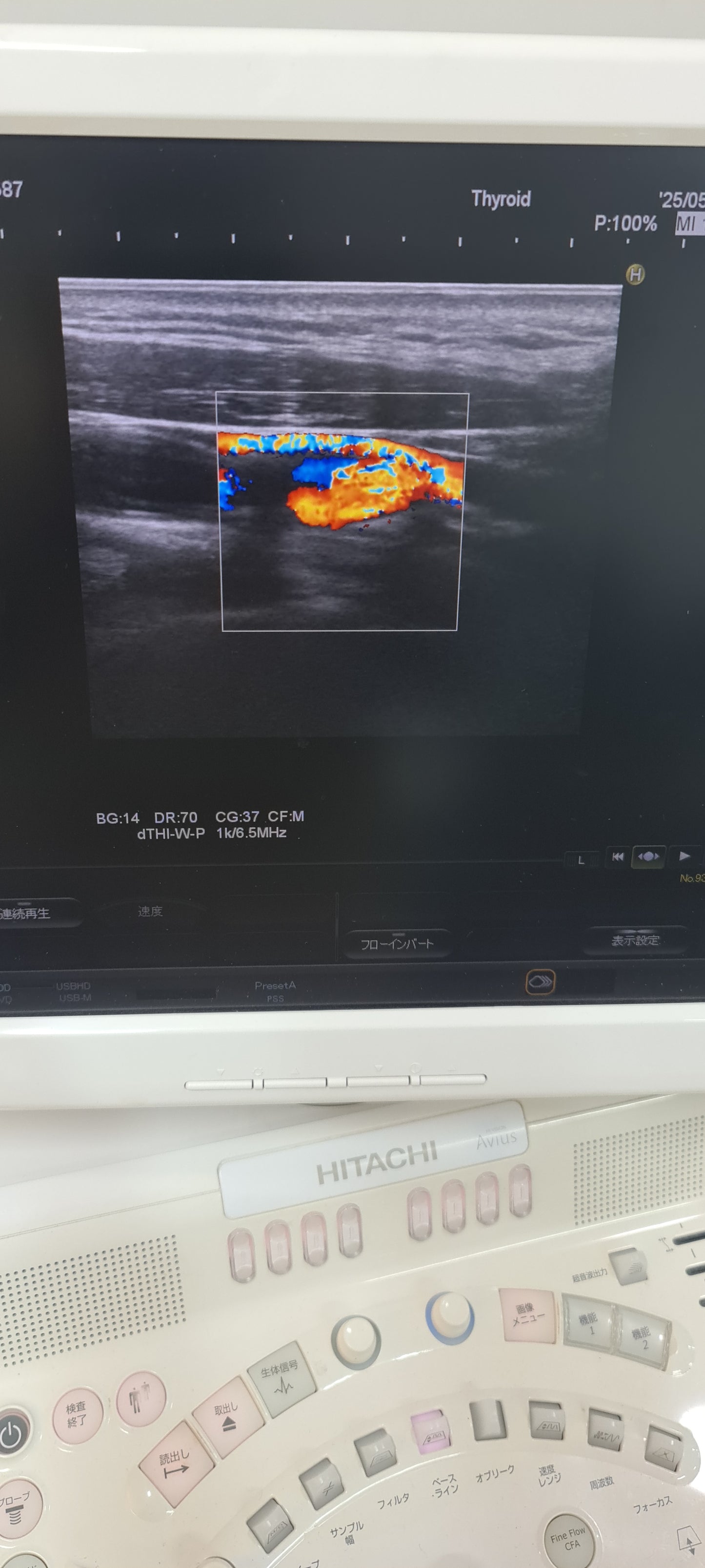 ..Hitachi EUP-L54MA linear probe Checked DXB