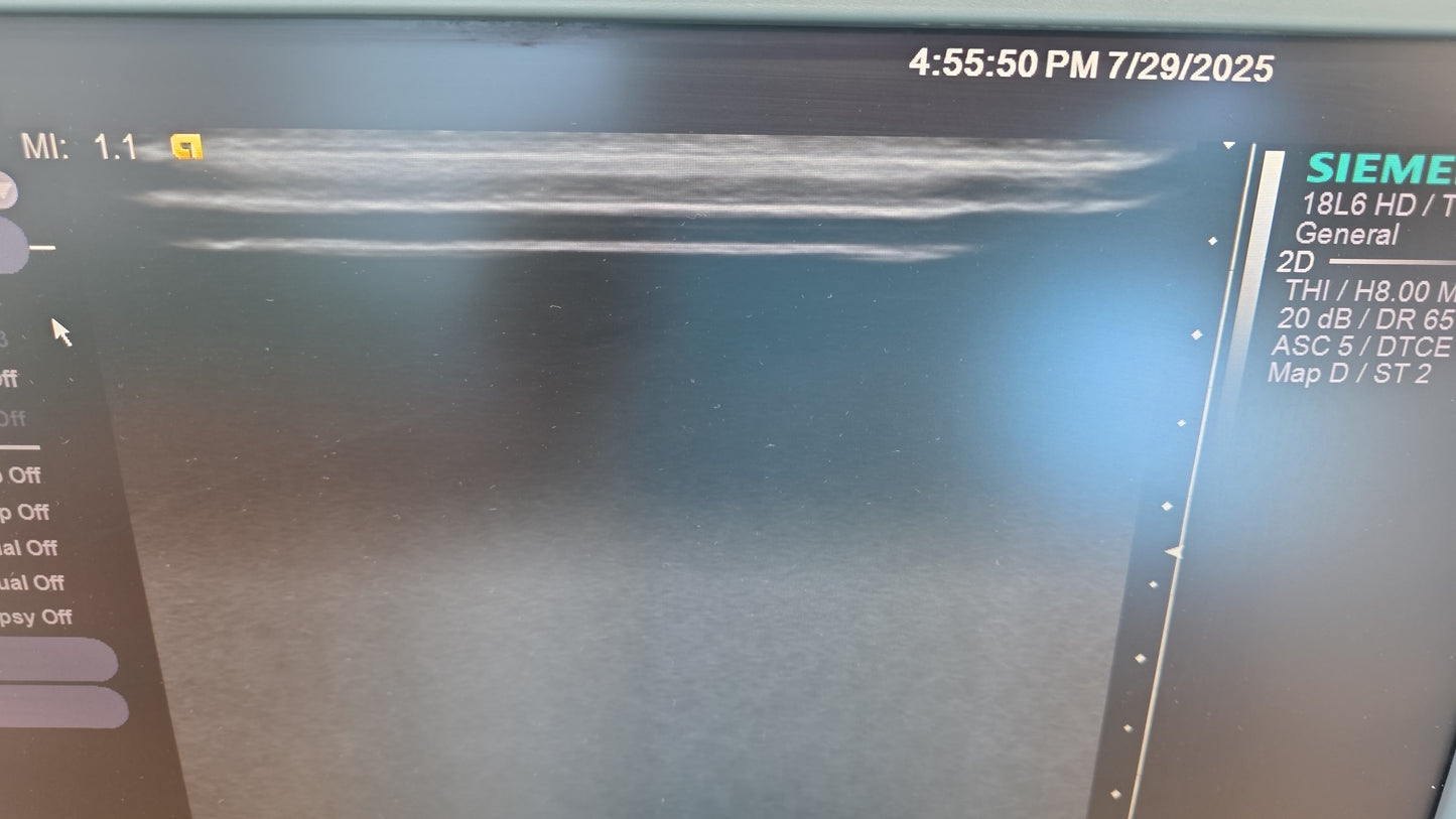 Siemens Acuson 18L6 HD Ultrasound Probe MFg: 2019 DXB checked ok