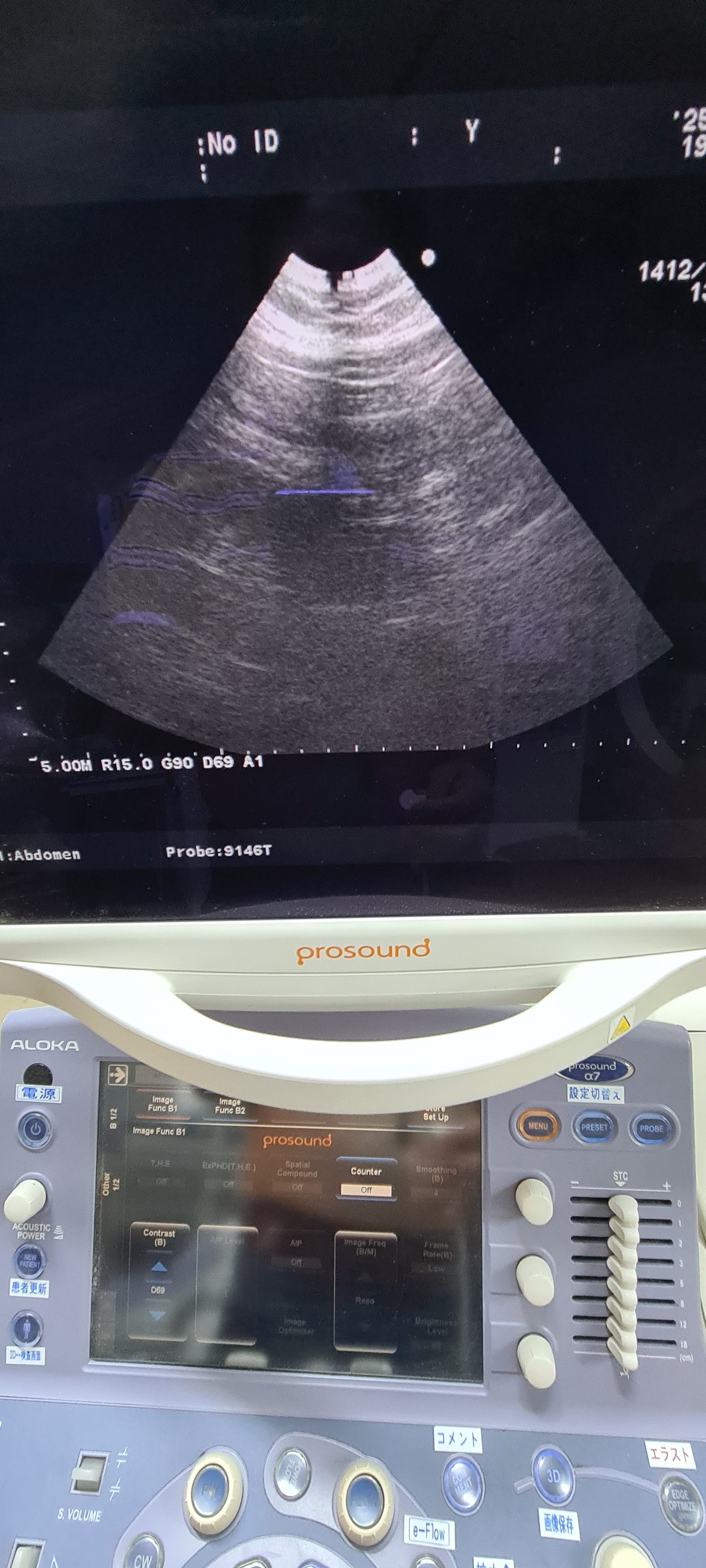 Aloka UST-9146T Micro Convex checked Av SN.20050115
