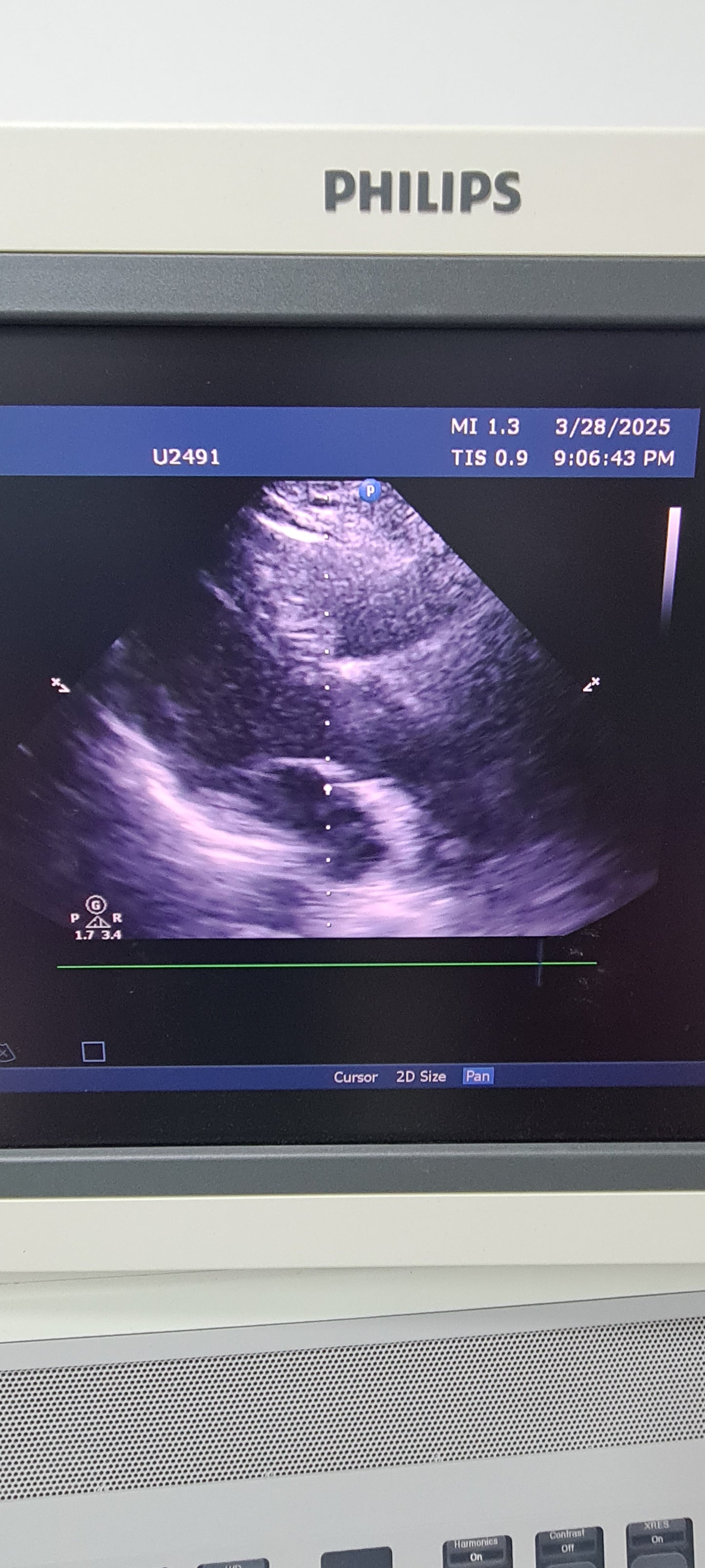 Philips S5-2 Prob cardiac checked