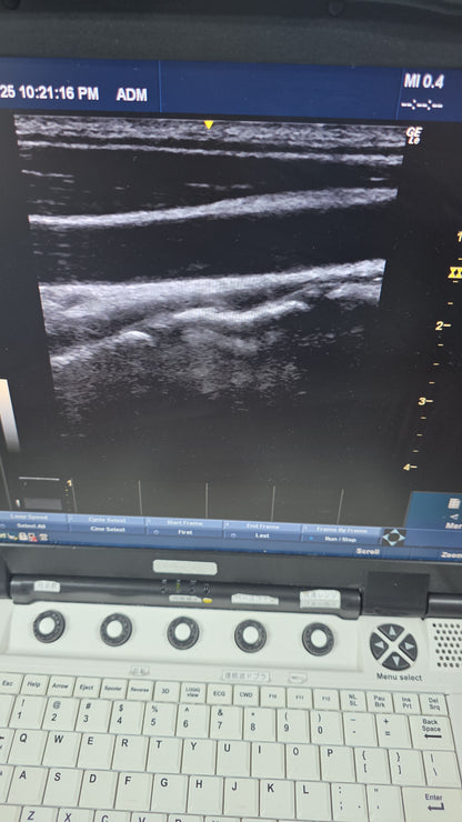 GE 12L-RS Linear probe YOM:2006 checked ok dxb