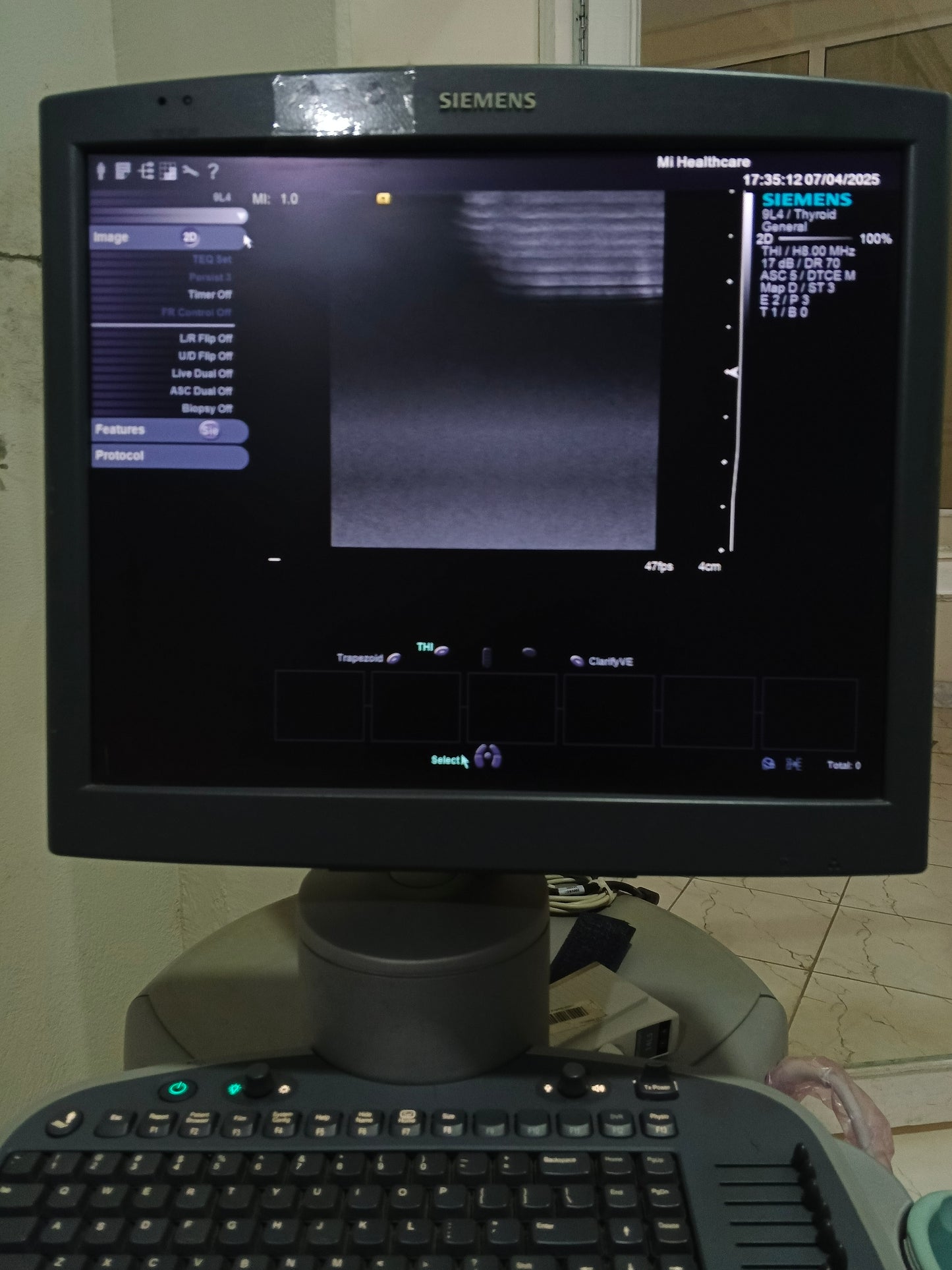 Siemen 9L4  linear probe