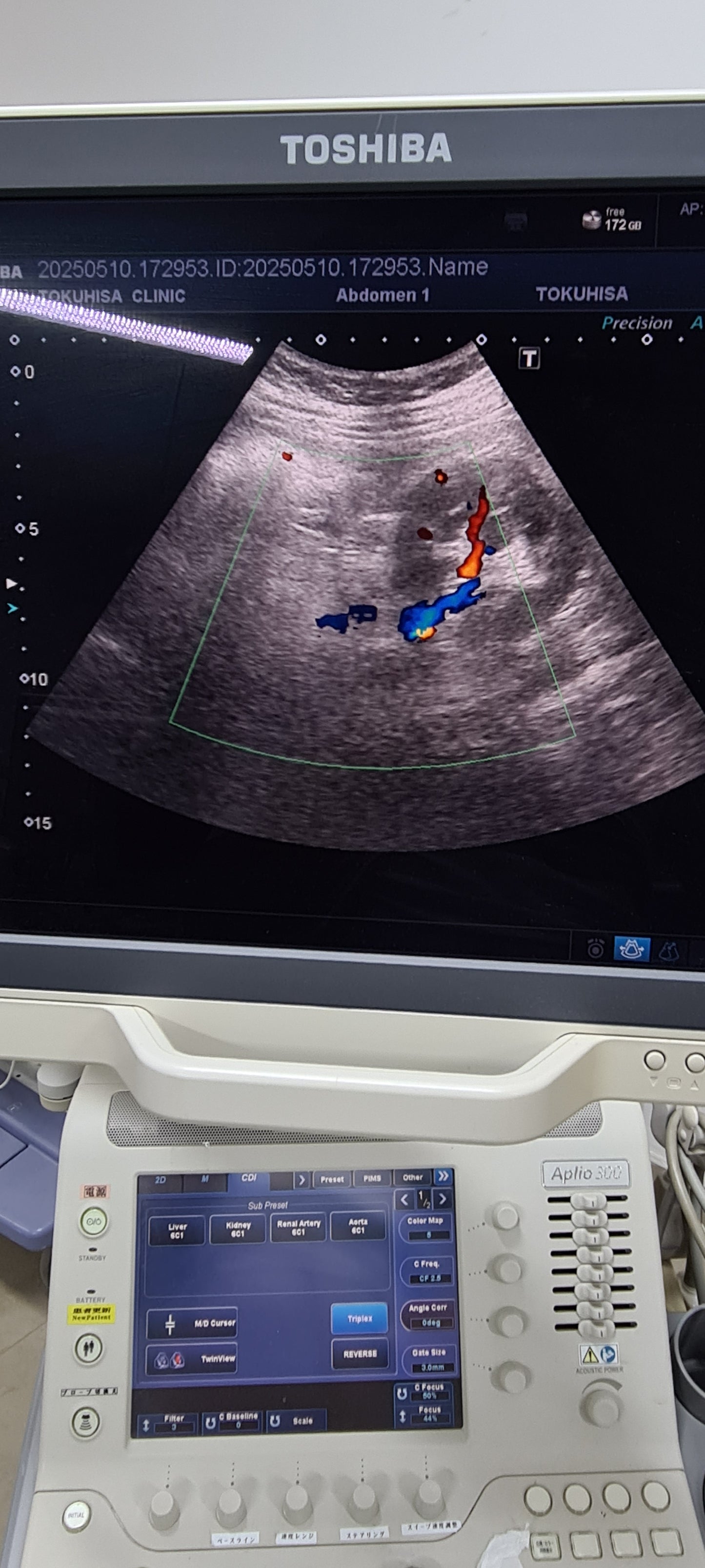 Toshiba 6C1 Convex Prob  checked SN: FDE2134652 dxb