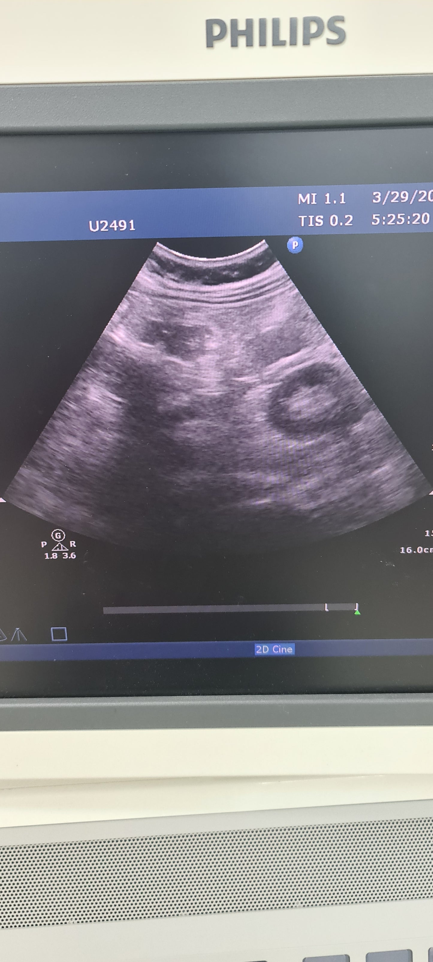 Philips C5-1 prob Convex checked B0QHBG  453561224465