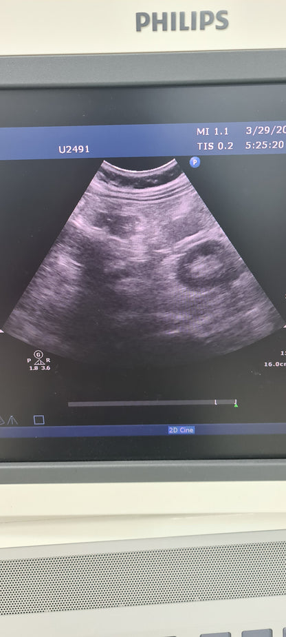 Philips C5-1 prob Convex checked B0QHBG  453561224465