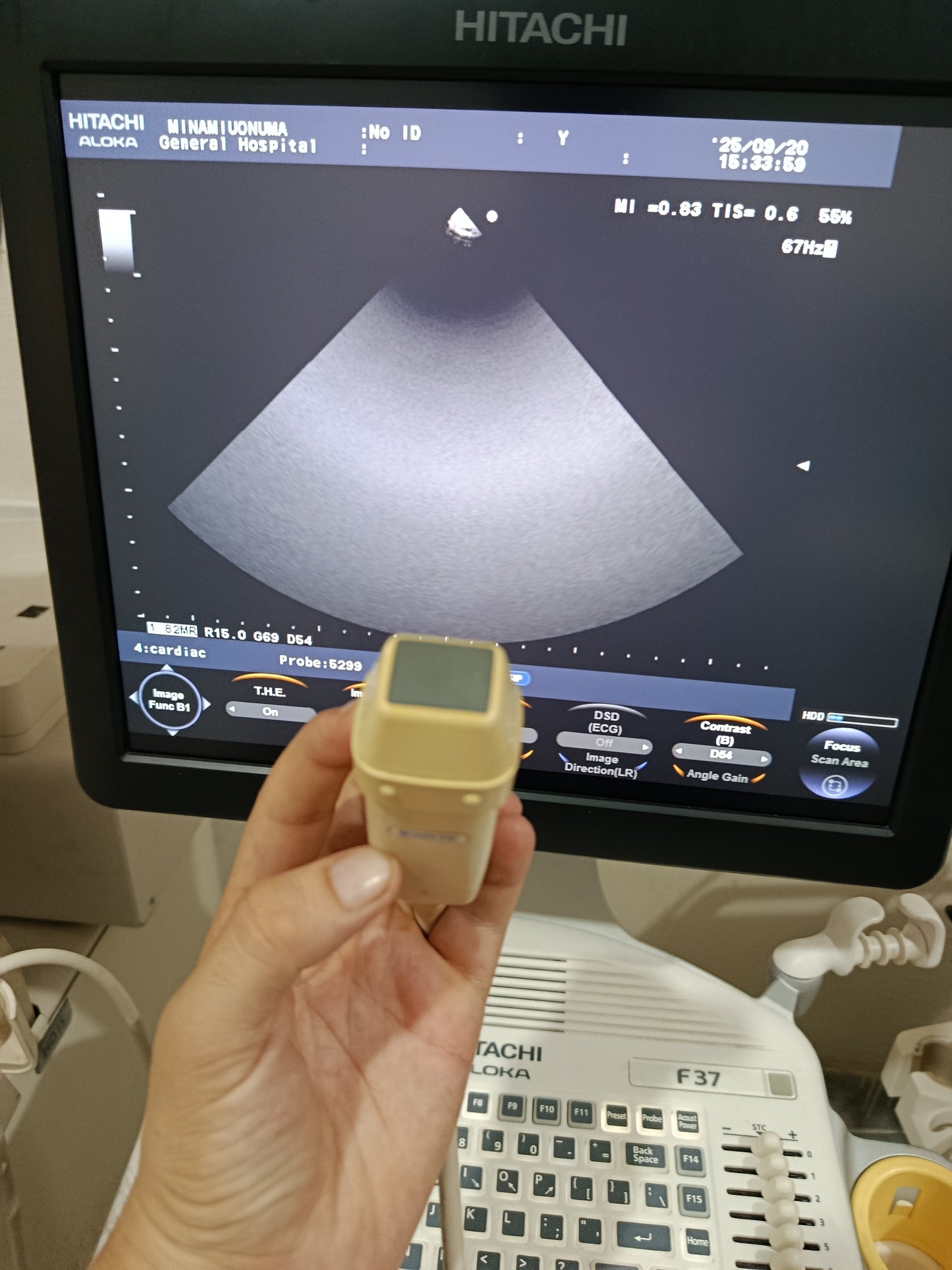 P…Aloka UST-5299 cardiac UCprobe