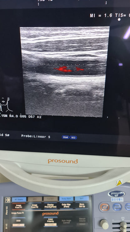 Aloka prob UST-5412 SN. M03744 checked