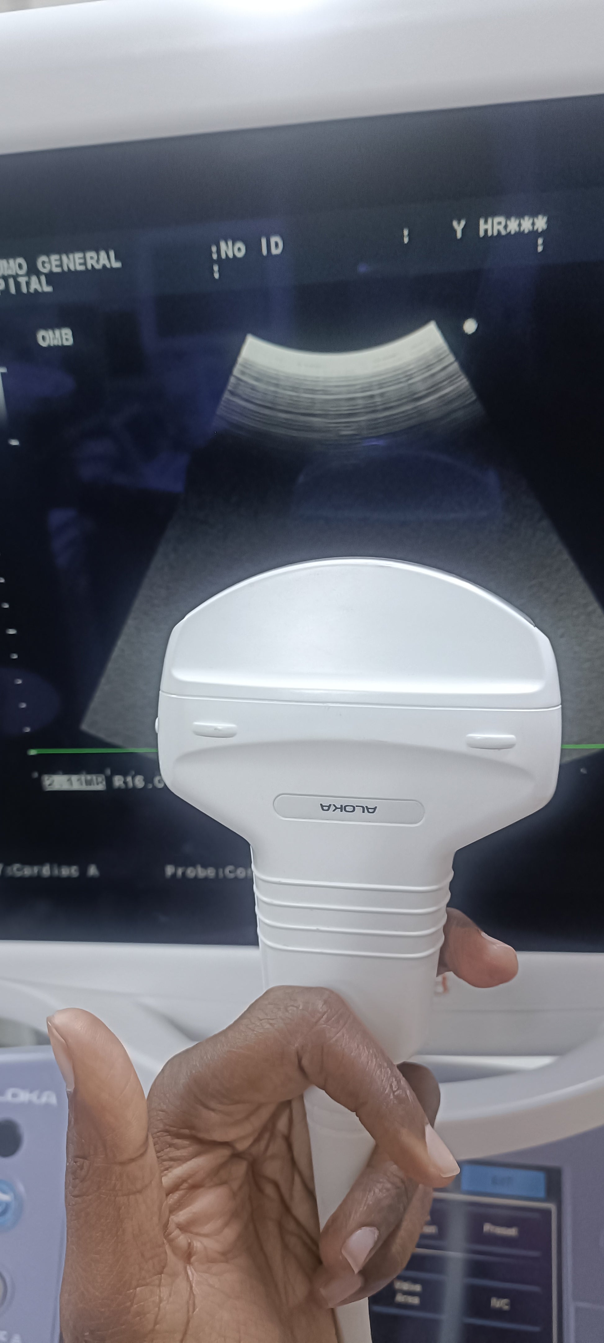 Aloka UST-9130 convex probe sn. X0003700 checked dxb - Japan Medical Company LTD