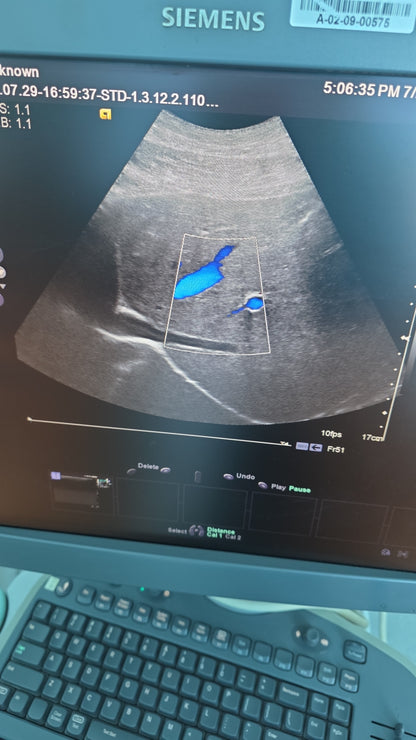 Siemens Acuson 6C2 Ultrasound Probe MFg: 2011 DXB checked ok