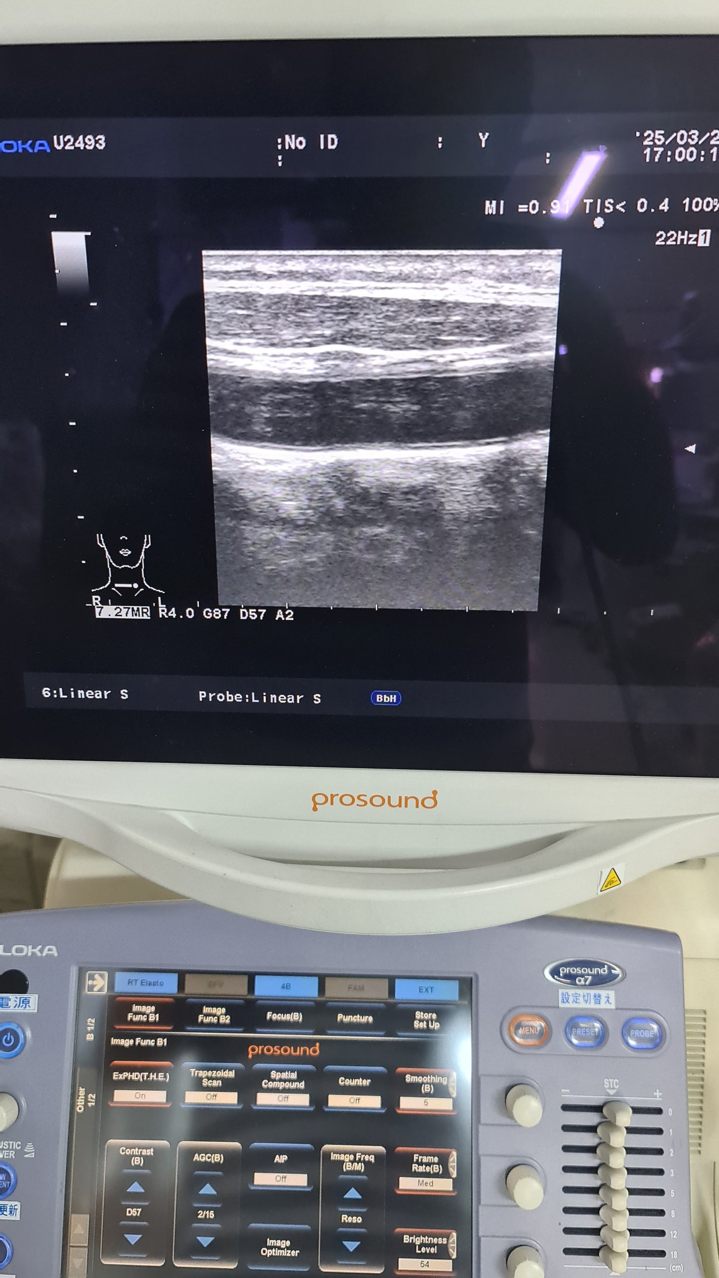 Aloka UST-5412 liner prob SN. M02414 checked