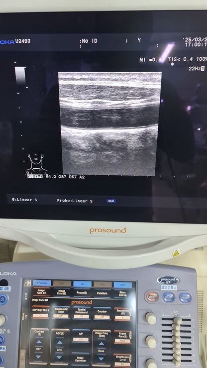 Aloka UST-5412 liner prob SN. M02414 checked