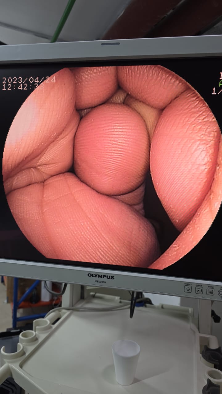 Fujinon EN-450T5/W S.NO: A0171C563 checked DXB