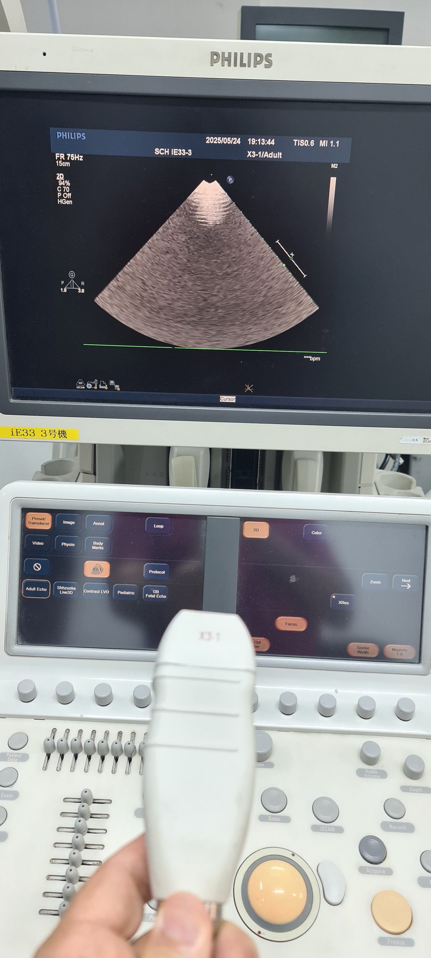 Philips X3-1 Matrix Array Probe SN: 02YKFK Checked dxb
