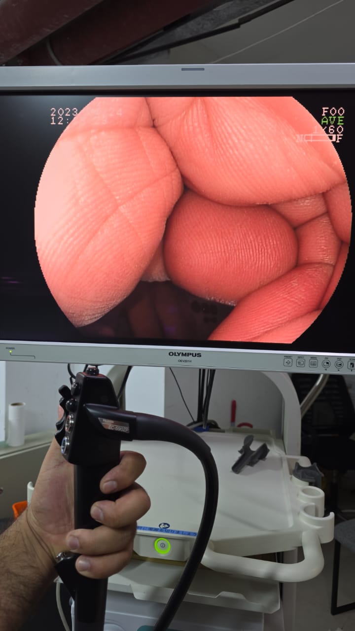 Fujinon Colonoscopy EC-590ZP S.NO: 2C671A047 checked DXB