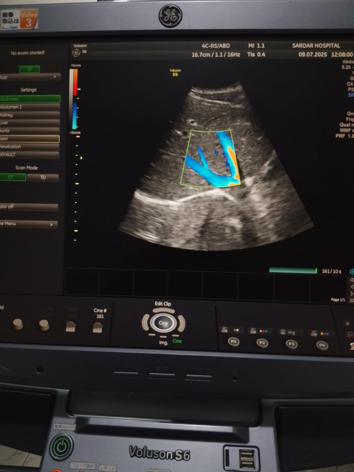 P..4c-Rs convex probe (17)