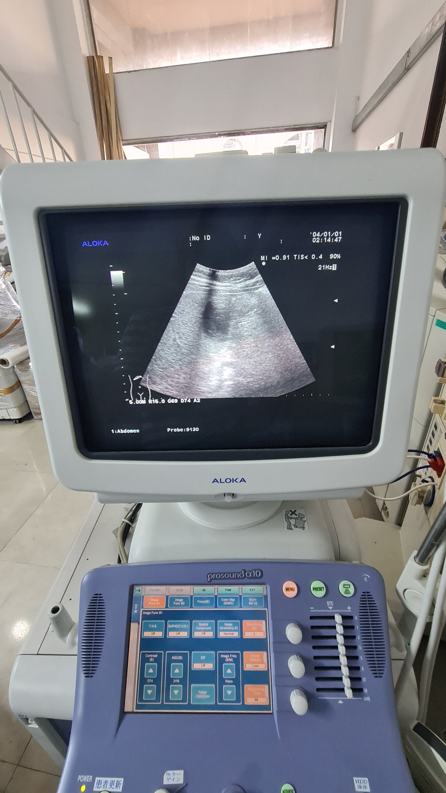 Aloka UST-9130 CONVEX checked SN. M05159C
