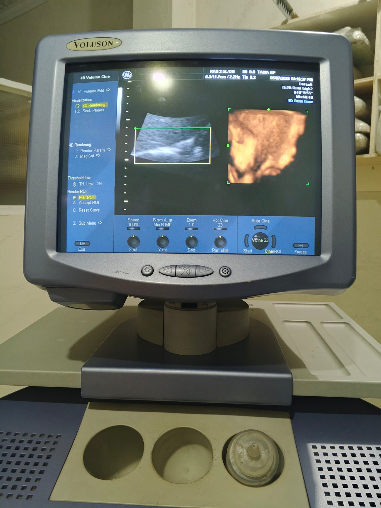 GE voluson 730 pro v 4D probe