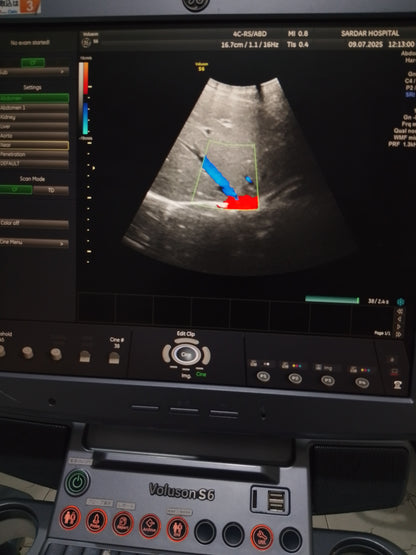 P..4c-Rs convex probe (18)