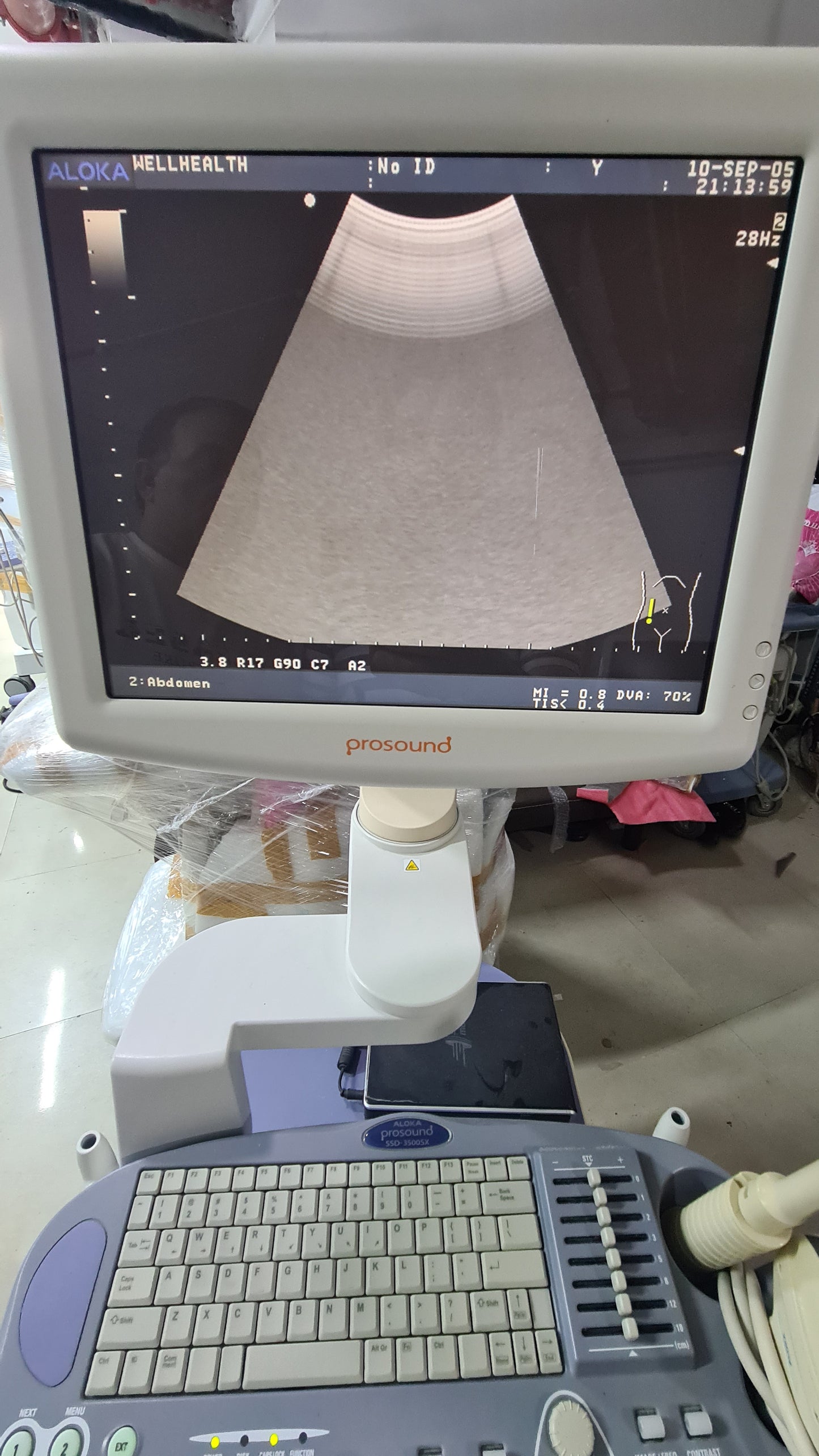 Z..Aloka UST-9123 SN. X0047168 checked Convex Probe dxb