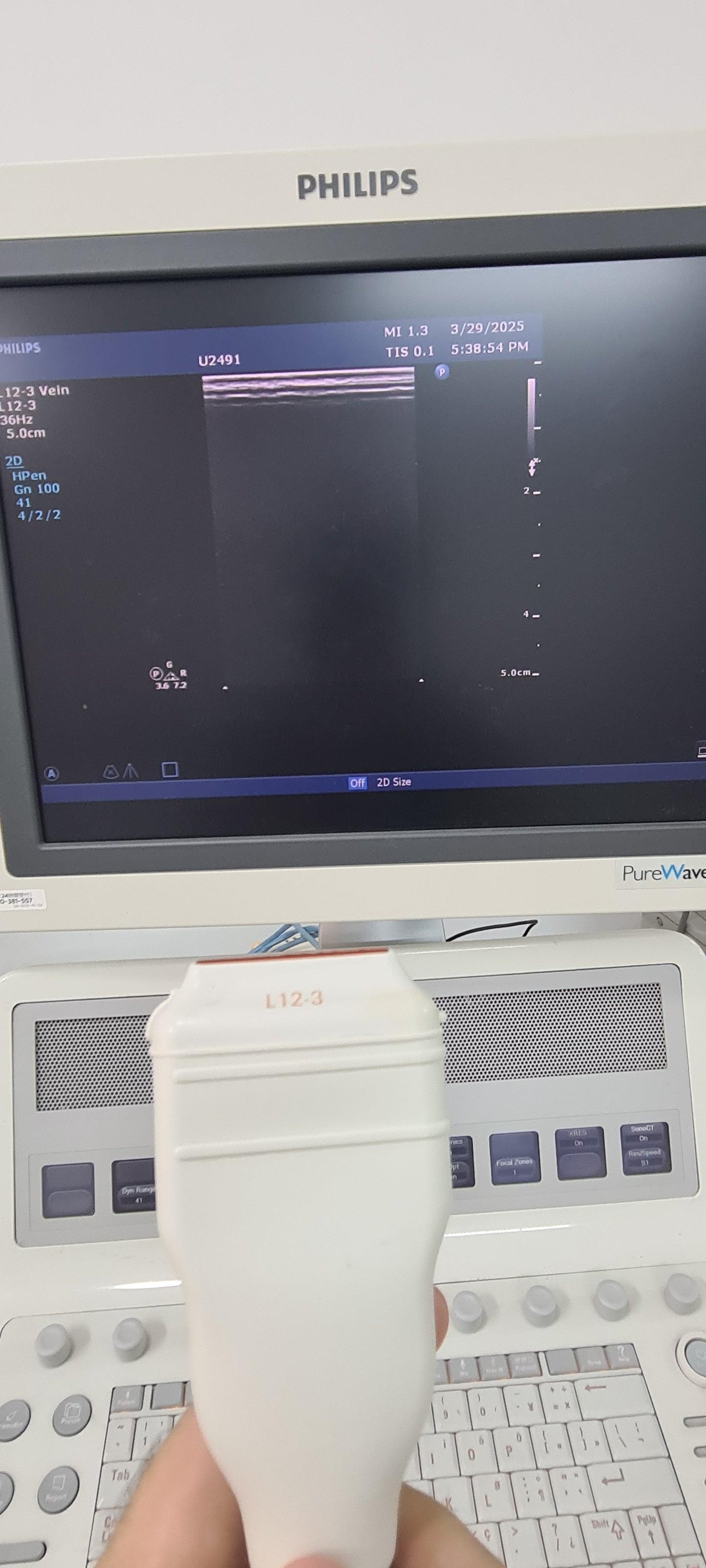 Philips L12-3 prob checked Ultrasound Transducer SN.2PFNQ PN. 453561182101