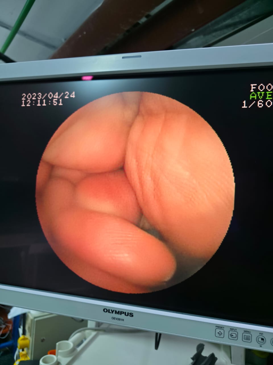 FUJINON GASTROSCOPY MODEL: FTS EG-530N S.NO: 3G250A187 CHECKED OK DXB