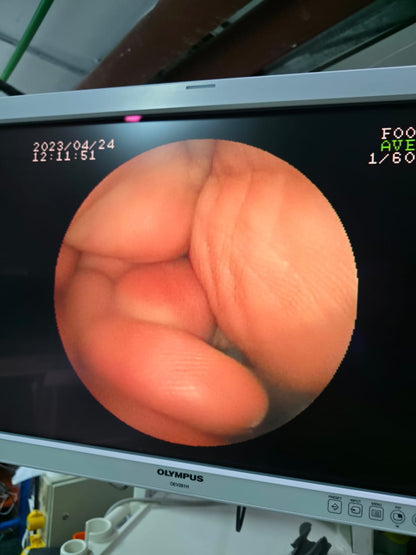FUJINON GASTROSCOPY MODEL: FTS EG-530N S.NO: 3G250A187 CHECKED OK DXB
