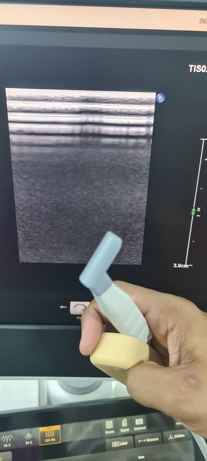 Philips L15-7io Hockey stick Prob  SN: B0K8N4 checked DXB