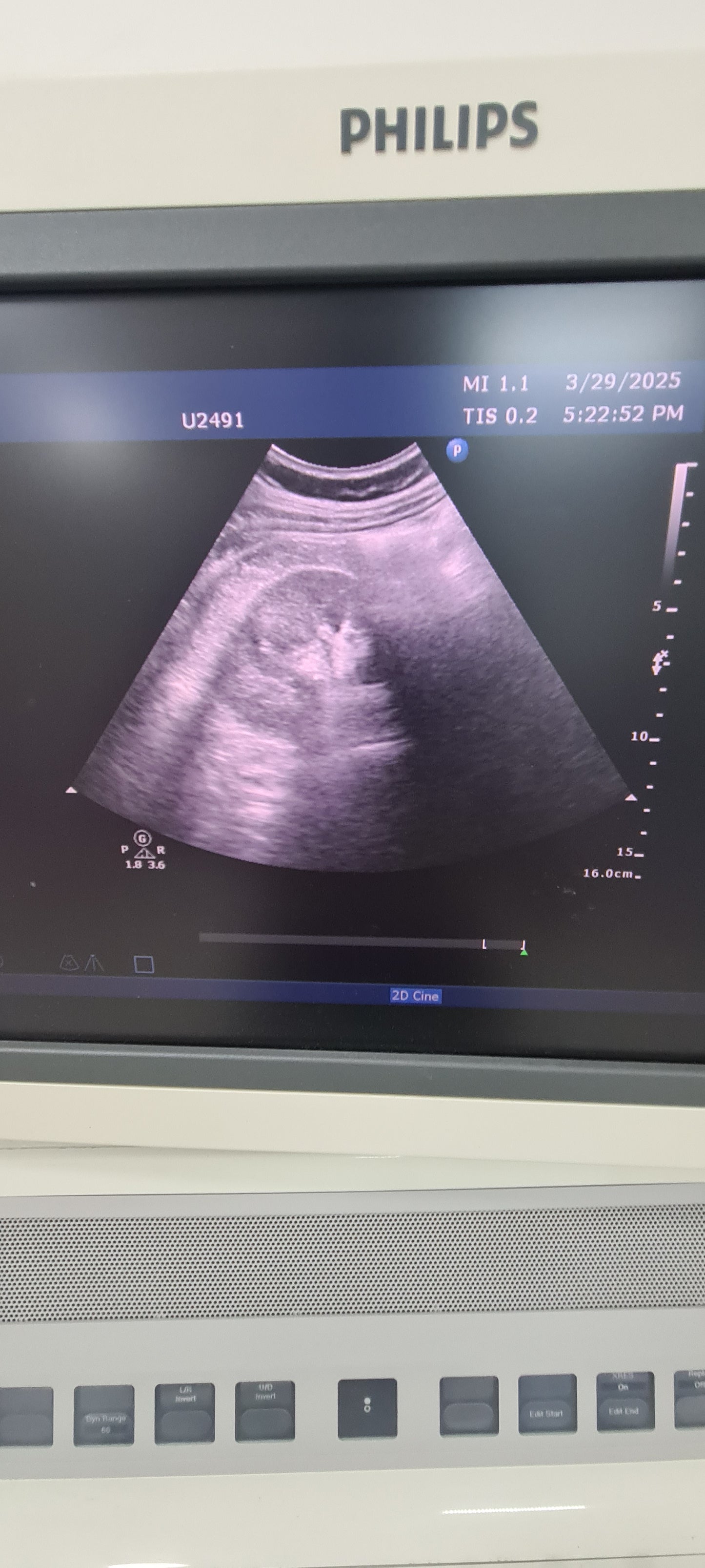 Philips C5-1 prob Convex checked B0QHBG  453561224465