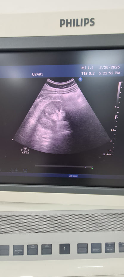 Philips C5-1 prob Convex checked B0QHBG  453561224465