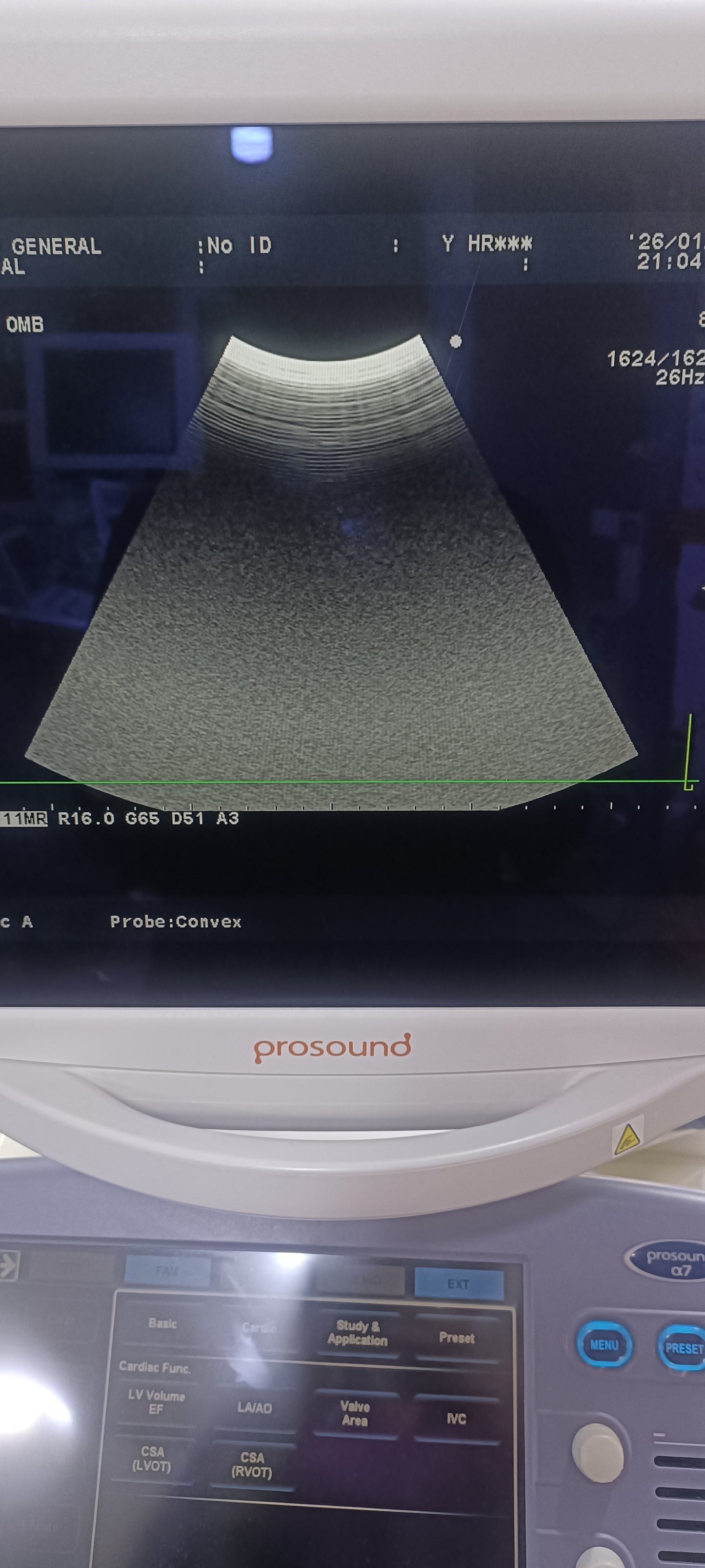 Aloka UST-9130 convex probe sn. X0003700 checked dxb - Japan Medical Company LTD