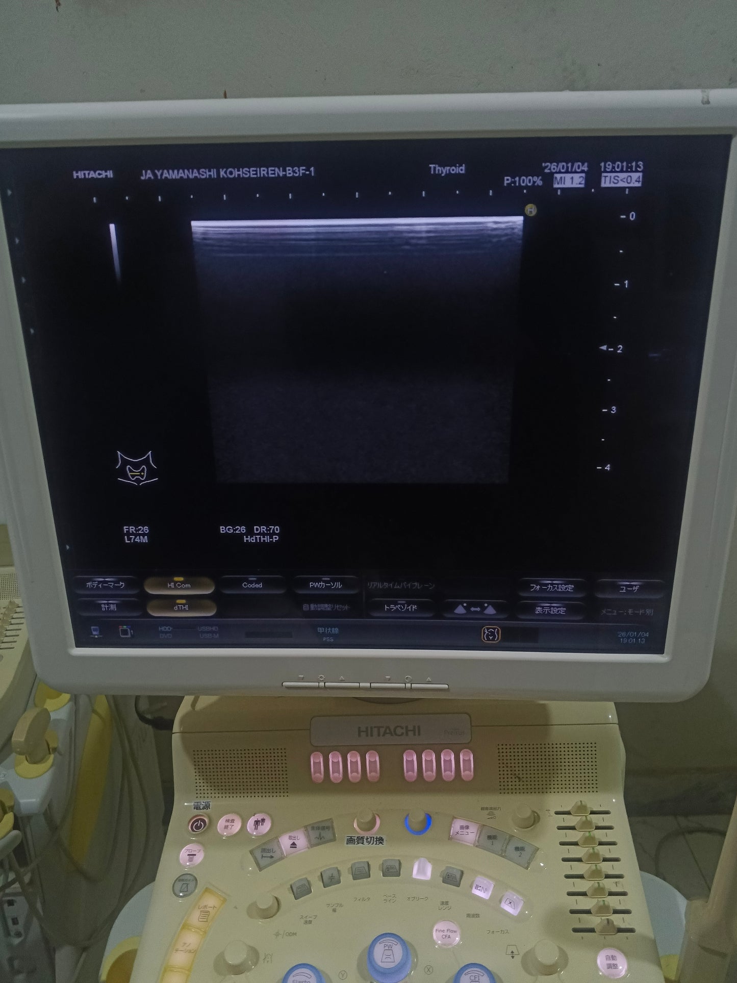 Hitachi avius Linear probe