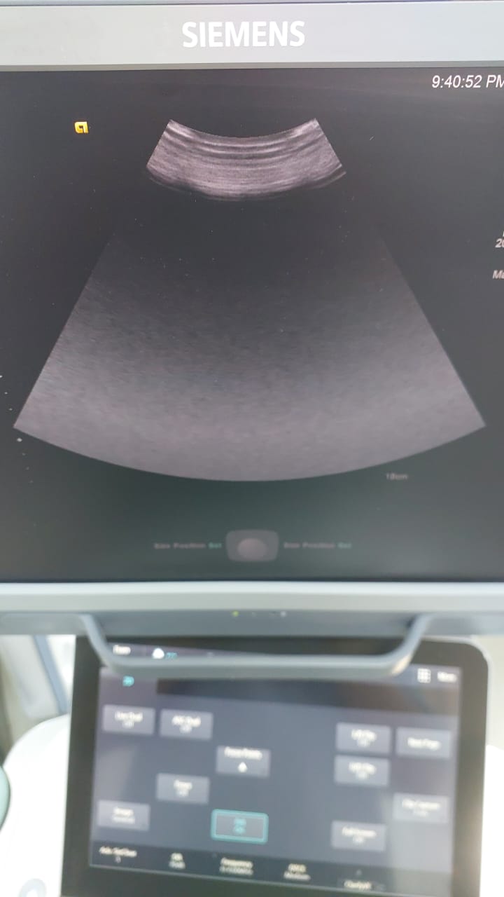 Siemens acuson 4C1 Curved Array Probe mfg: 2009