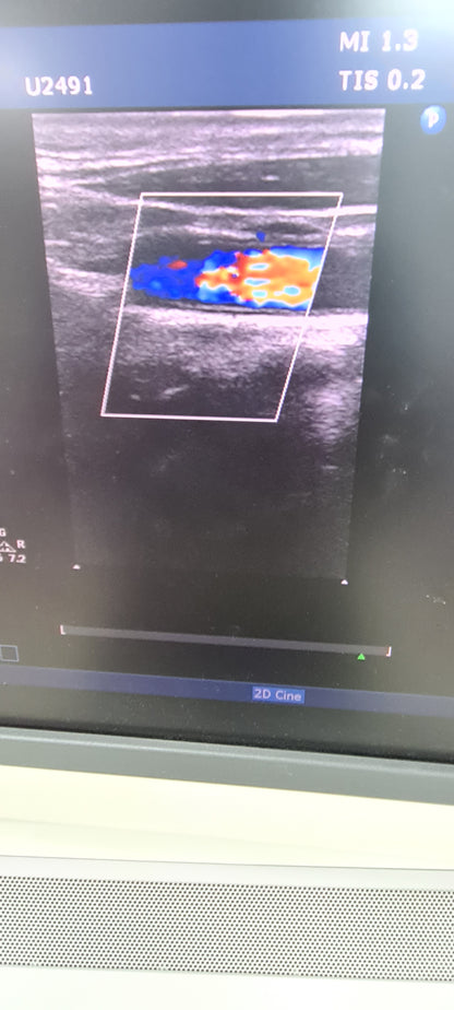 Philips L12-3 prob checked Ultrasound Transducer SN.2PFNQ PN. 453561182101